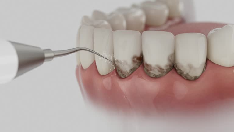 Reliable Dental Implants contractor in Chaska, MN by Smile Center Dentistry